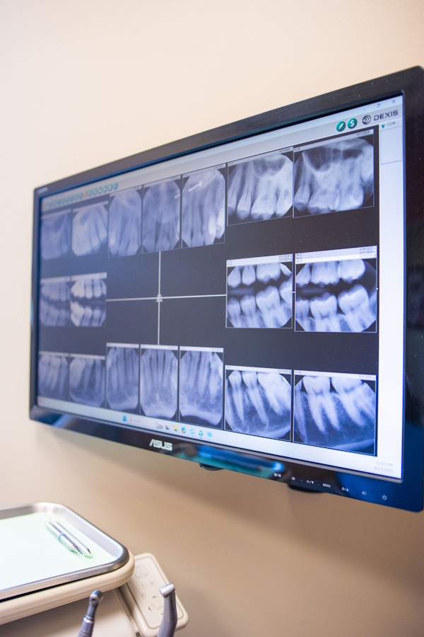 photo of a monitor showing x-rays of teeth